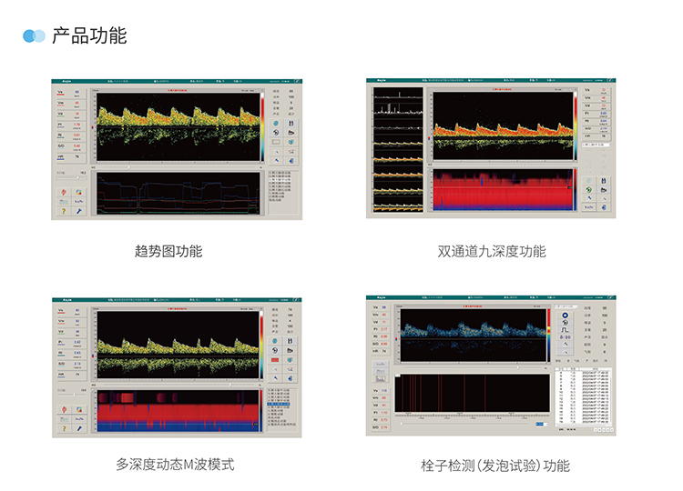 便攜經(jīng)顱多普勒產(chǎn)品功能